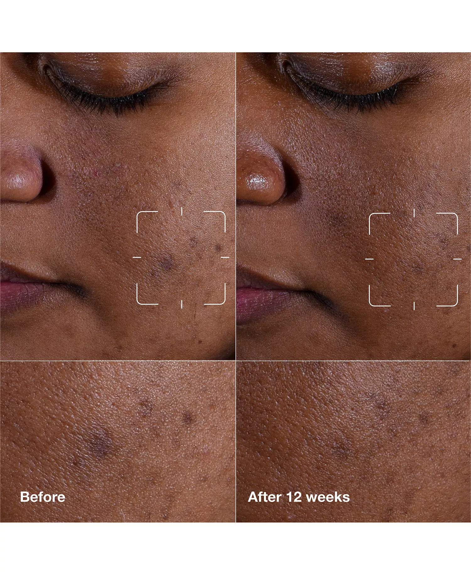 3-Pc. Brightening Routine: Mini Even Better Skincare Kit - No Color - No Size