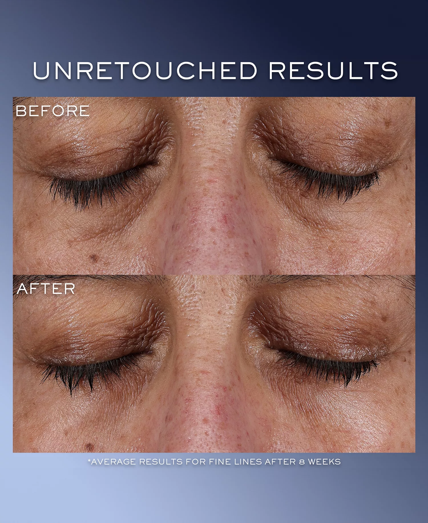 3-Pc. Génifique Ultimate Serum Mother's Day Skincare Set - No Color - No Size