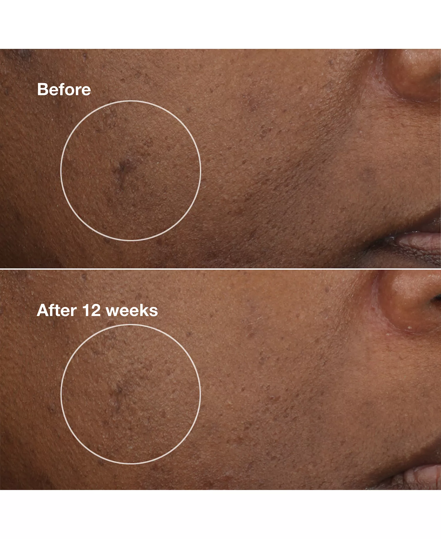 3-Pc. Brightening Routine: Mini Even Better Skincare Kit - No Color - No Size