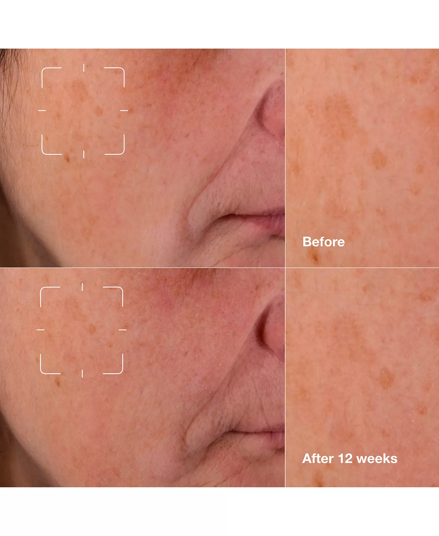 3-Pc. Brightening Routine: Mini Even Better Skincare Kit - No Color - No Size