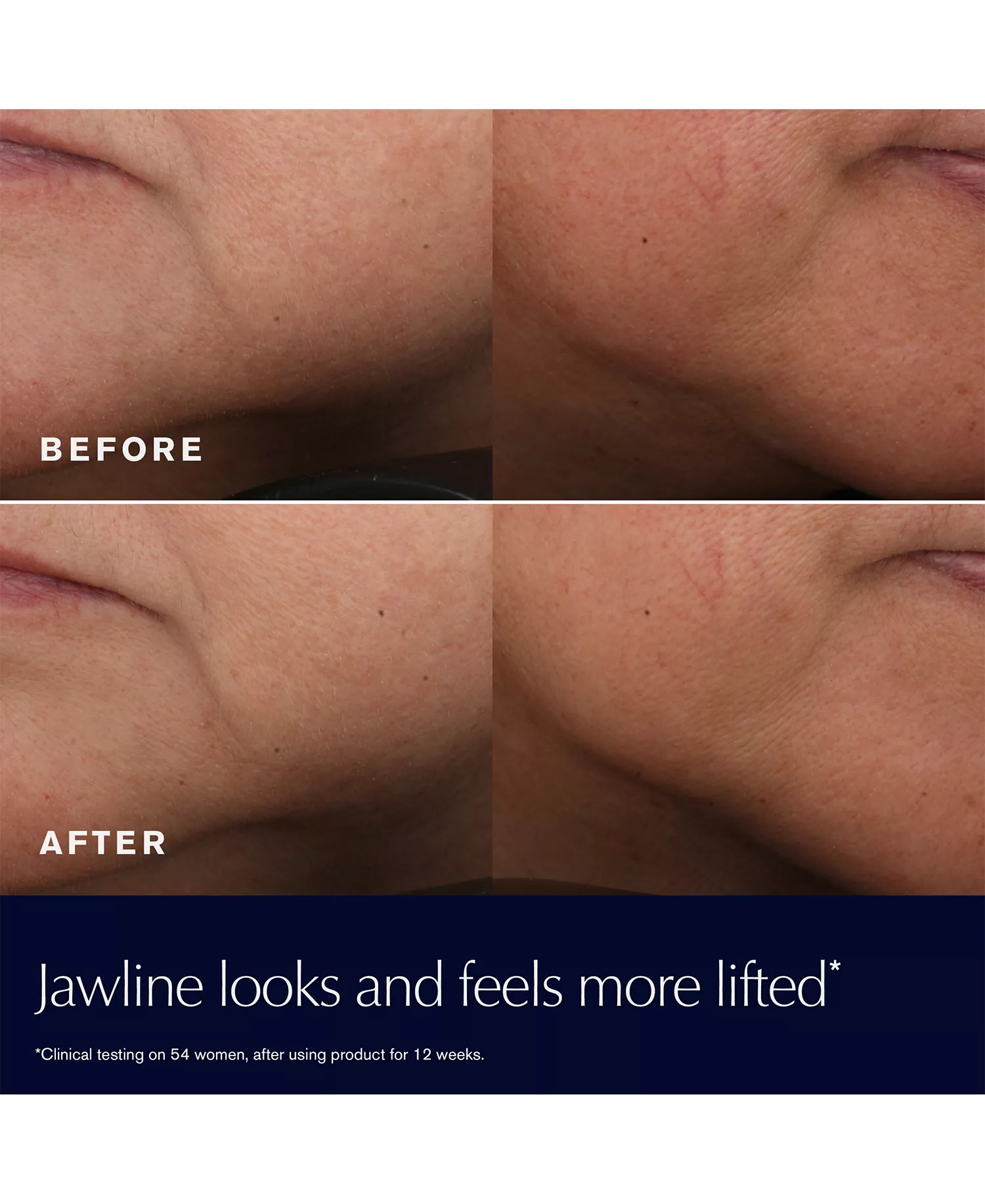 2-Pc. Revitalizing Supreme+ Moisturizer Gift Set - No Color - Gift Set