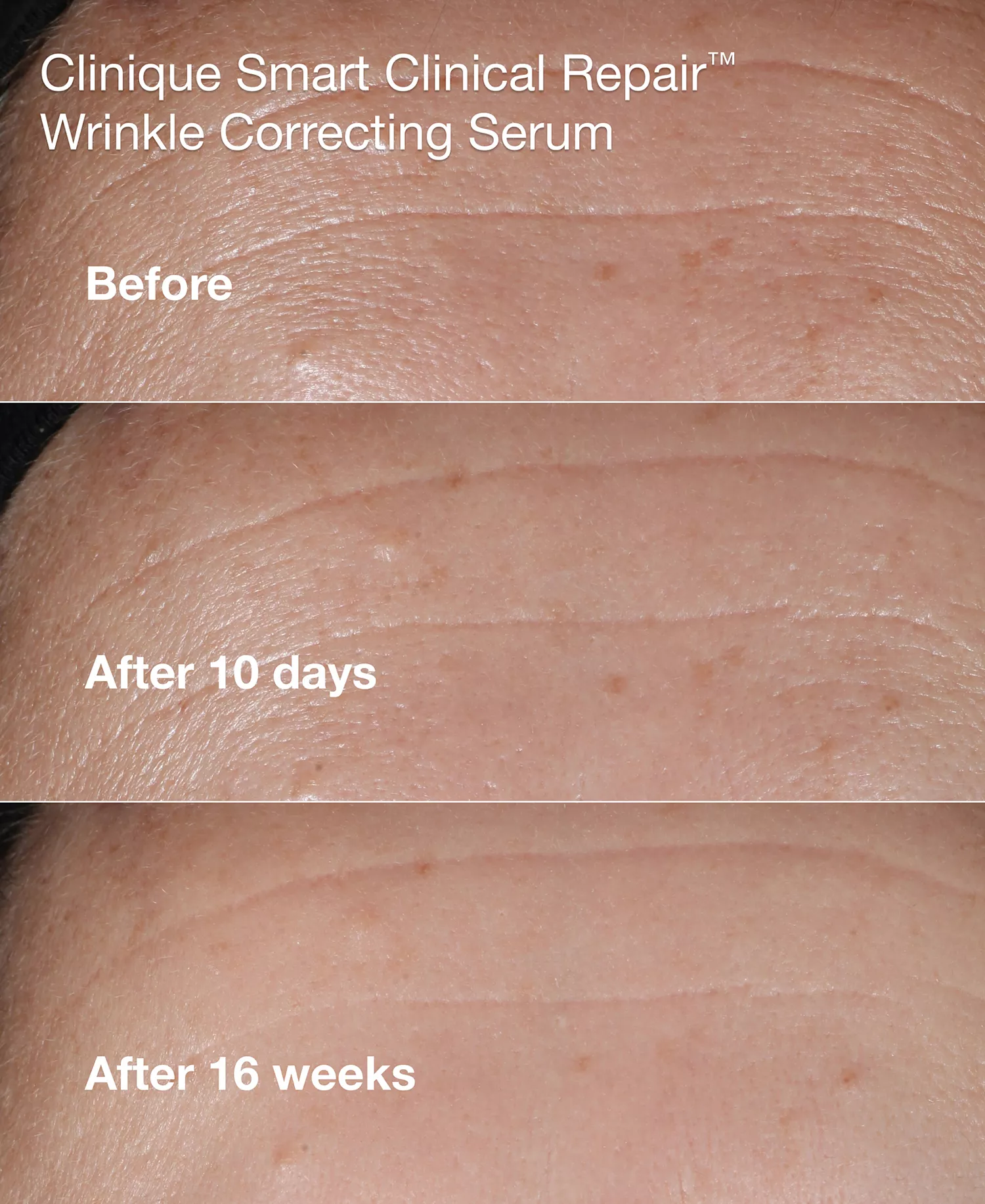 3-Pc. Mini Smart Clinical Repair Skincare Set - No Color - No Size