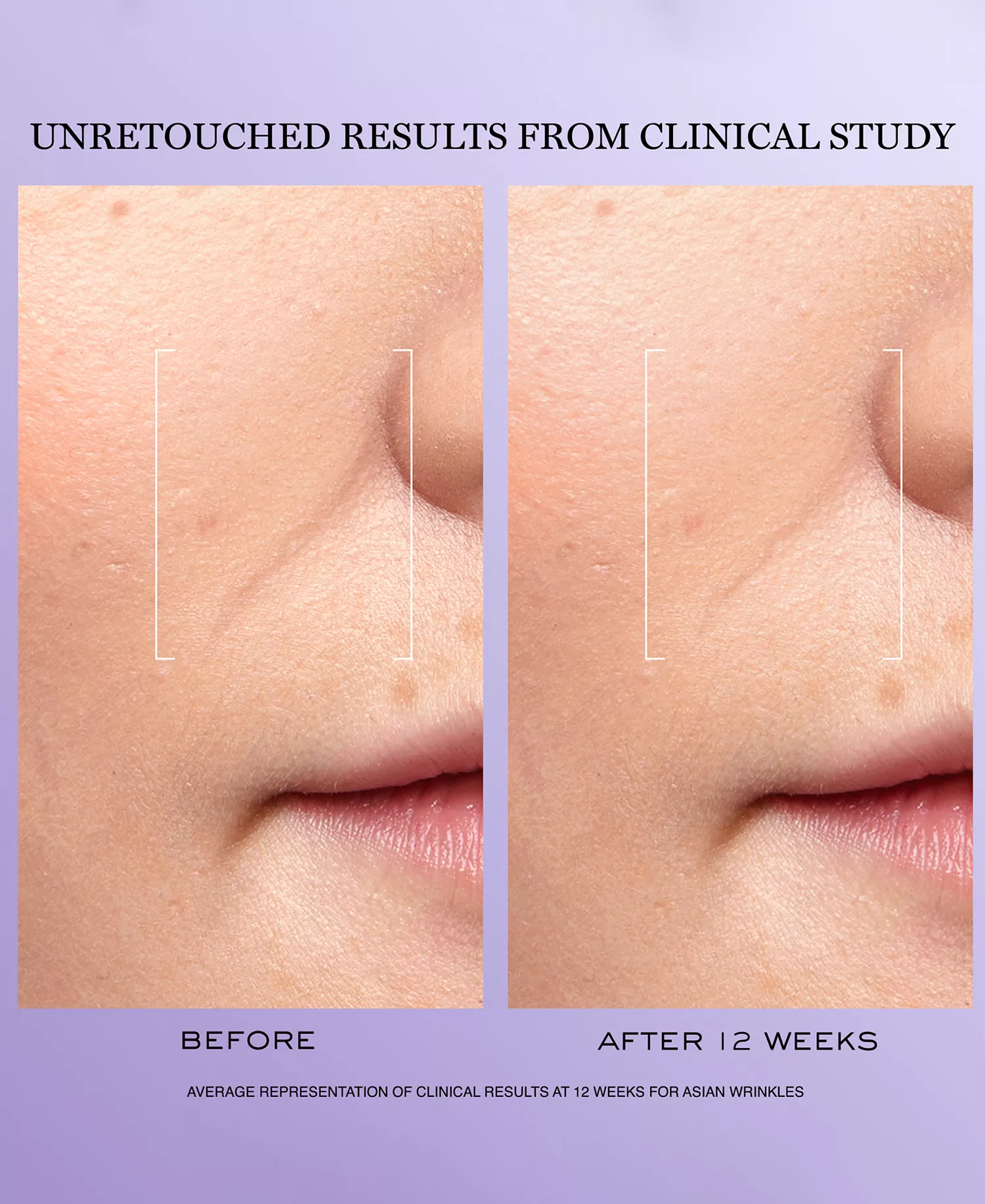 3-Pc. Rénergie H.C.F. Triple Serum Discovery Set - No Color - No Size