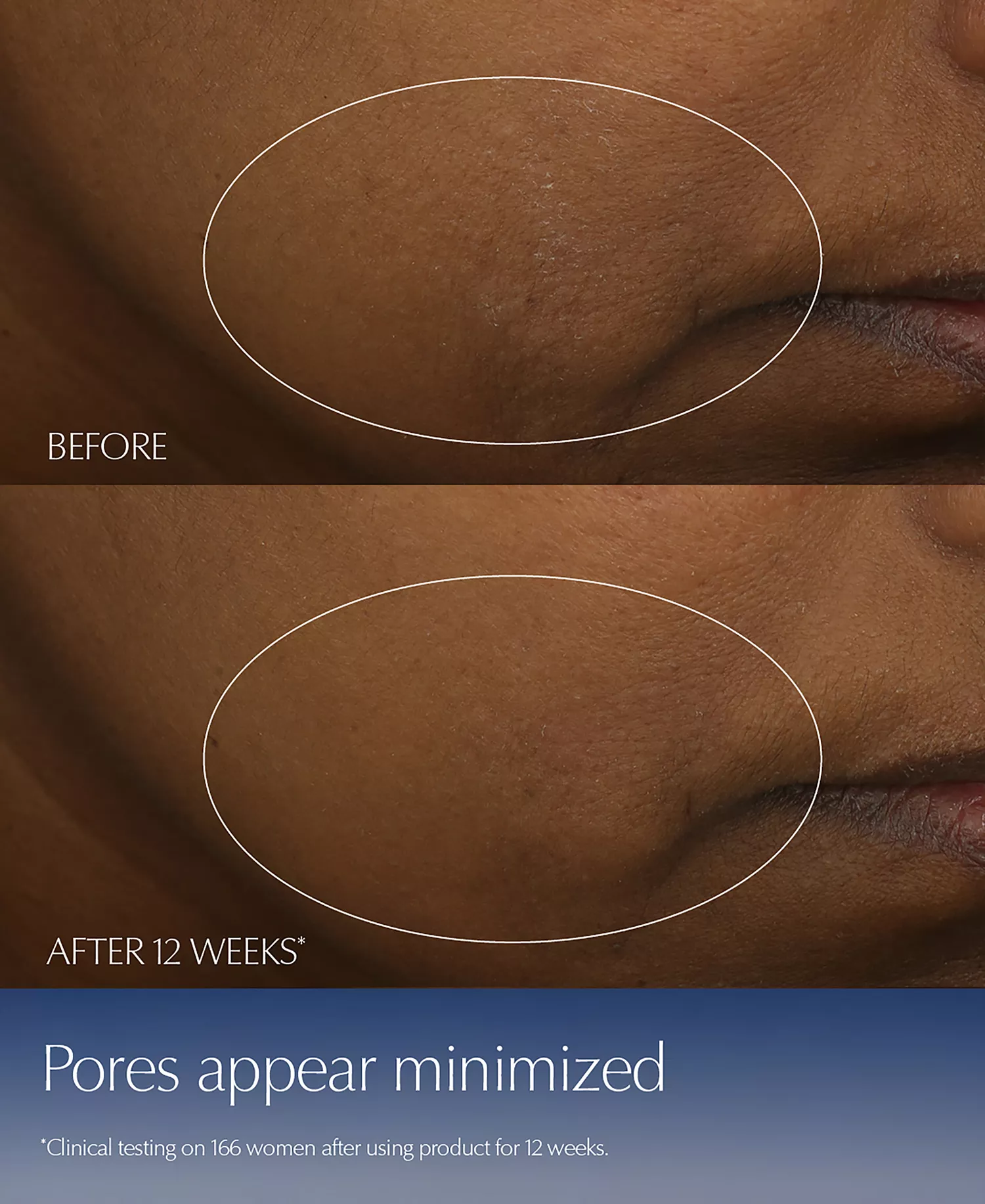 Advanced Night Repair Duo Synchronized Multi-Recovery Complex Serum with Hyaluronic Acid & Peptides, 1.7 oz Duo - No Color - 0.23 oz