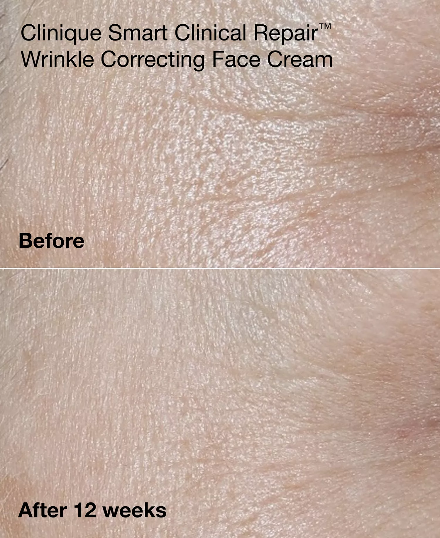 3-Pc. Mini Smart Clinical Repair Skincare Set - No Color - No Size