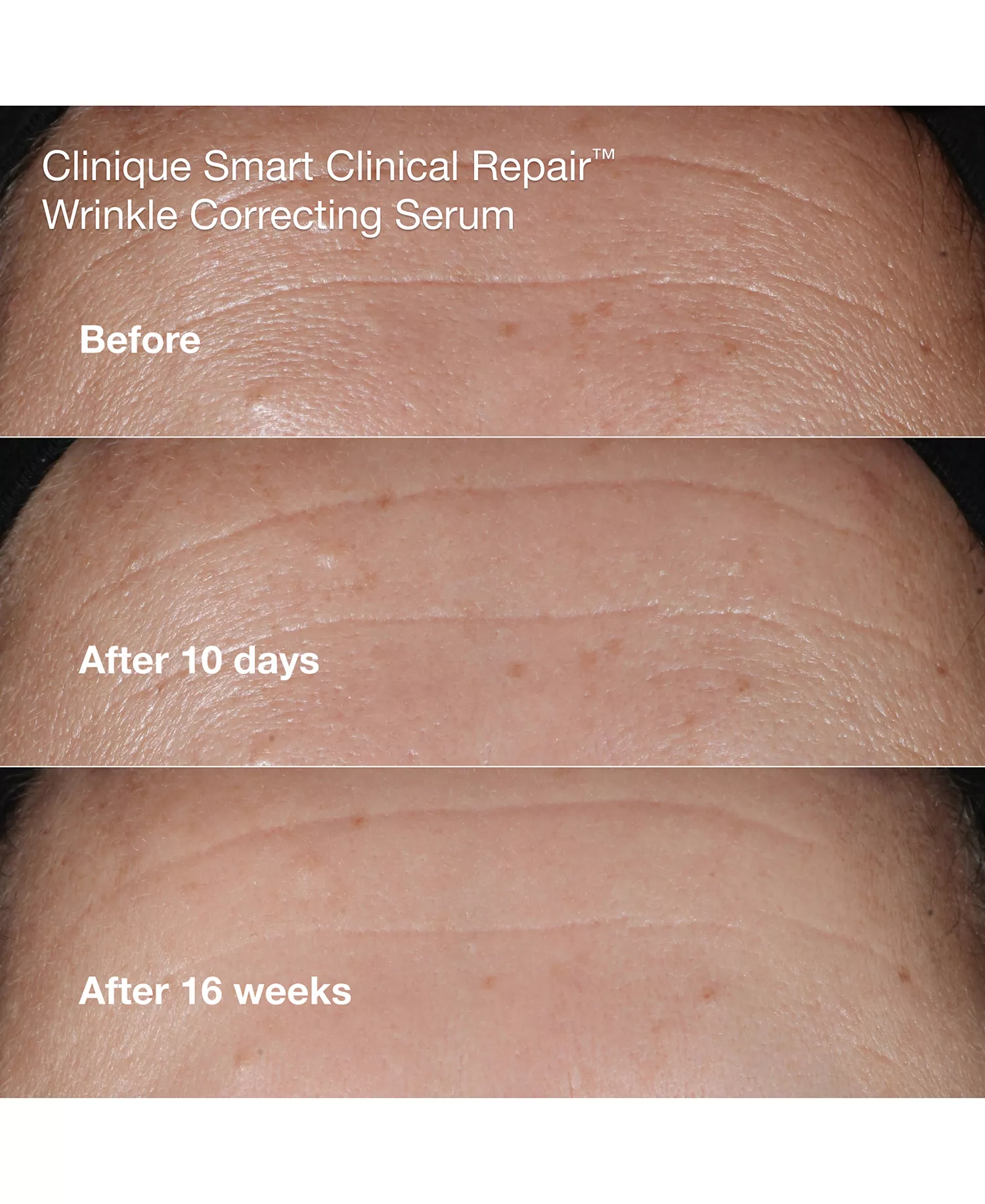 Wrinkle-Fighting Routine Anti-Aging Skin Care Gift Set