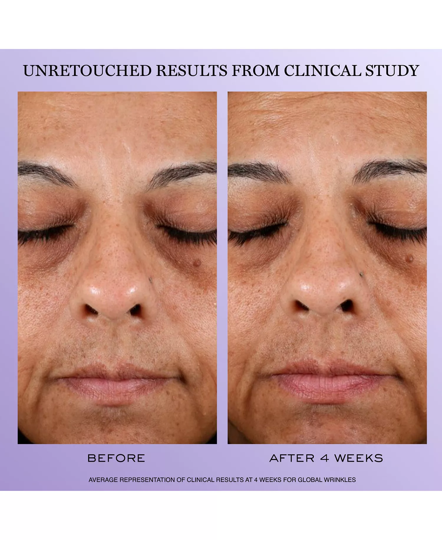 4-Pc. Rénergie Starter Kit Set - No Color - No Size