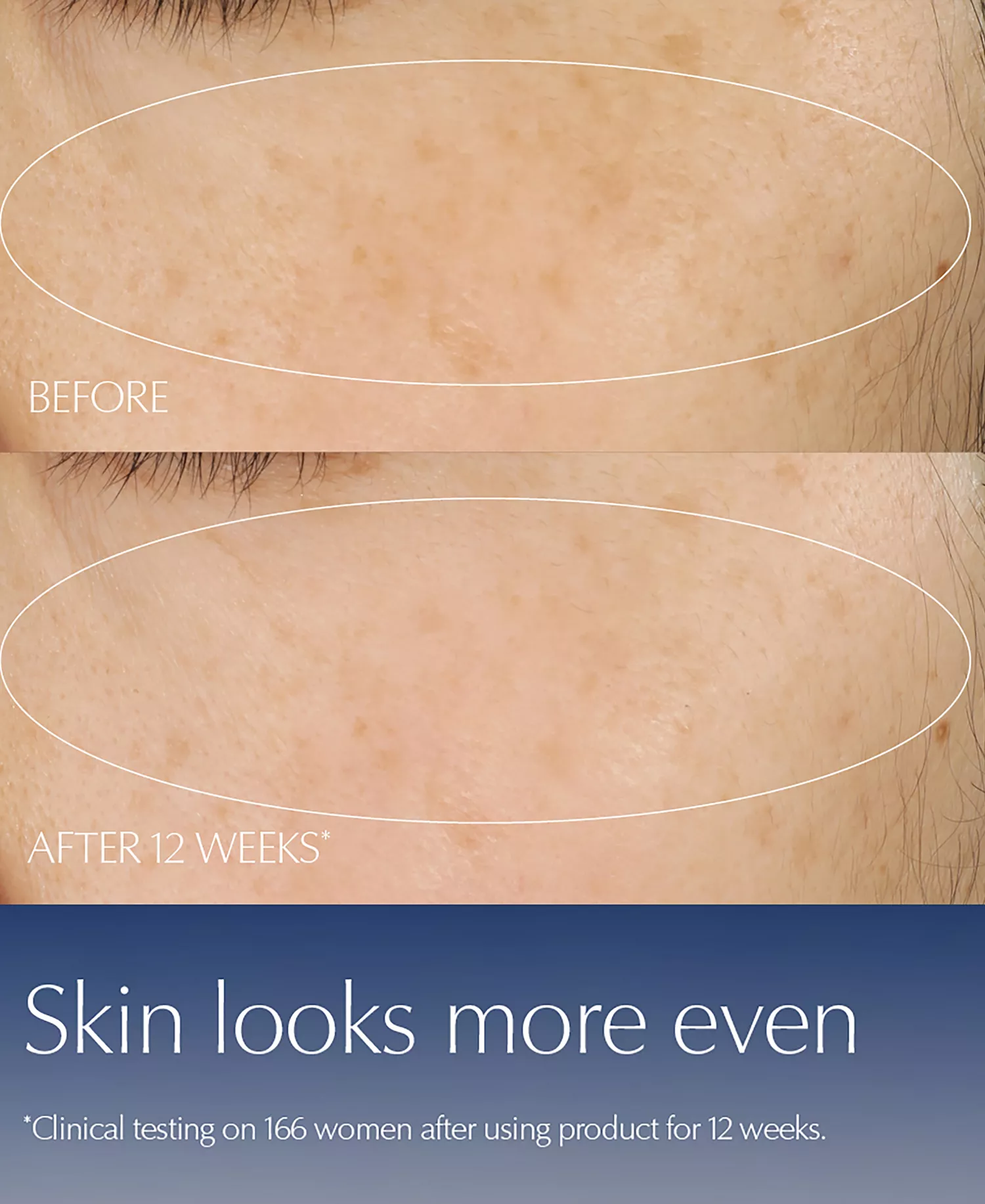 Advanced Night Repair Duo Synchronized Multi-Recovery Complex Serum with Hyaluronic Acid & Peptides, 1.7 oz Duo - No Color - 0.23 oz