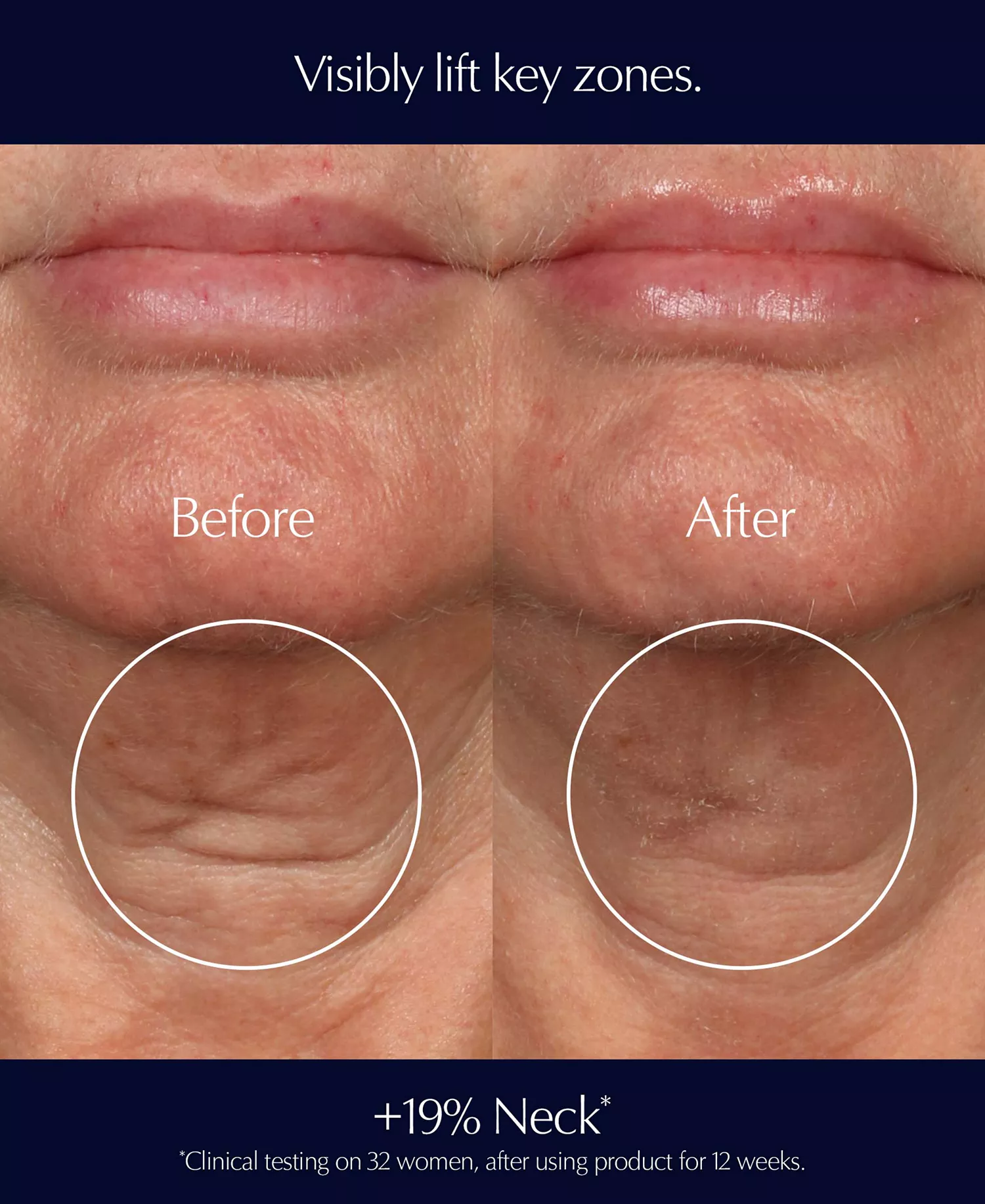 2-Pc. Perfectionist Pro Rapid Firm + Lift Serum with Hexapeptides Duo Set