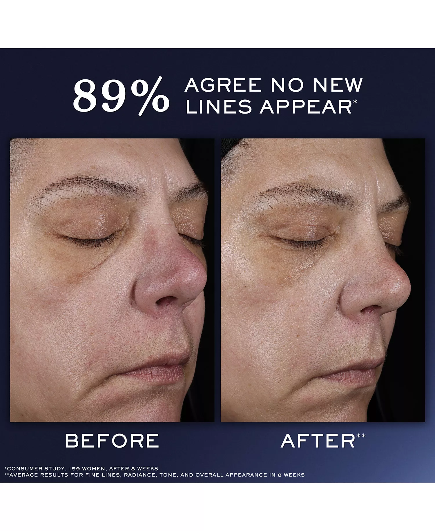 4-Pc. Rénergie Starter Kit Set - No Color - No Size