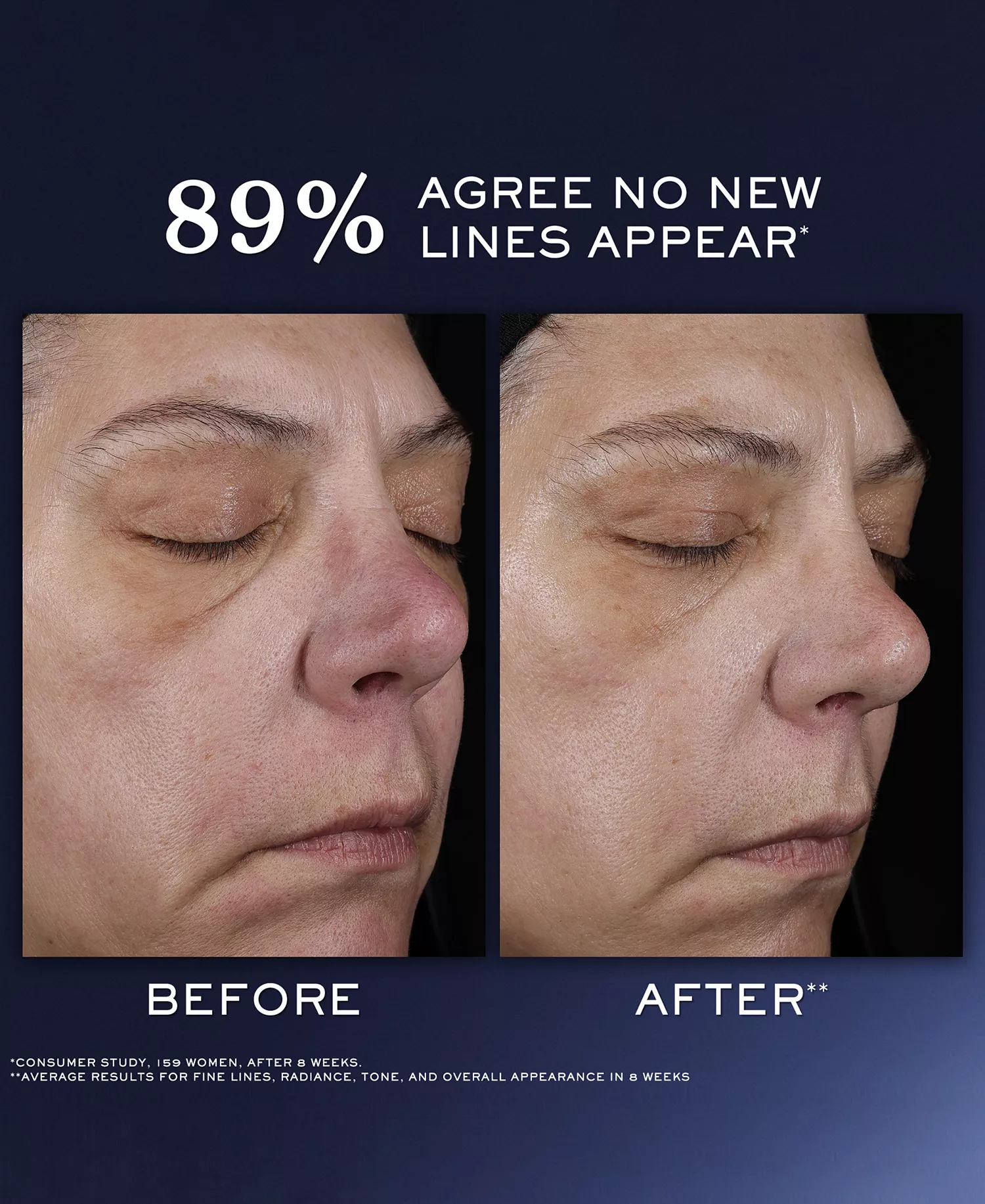 2-Pc. Génifique Ultimate Recovery Serum Duo Set - No Color - No Size