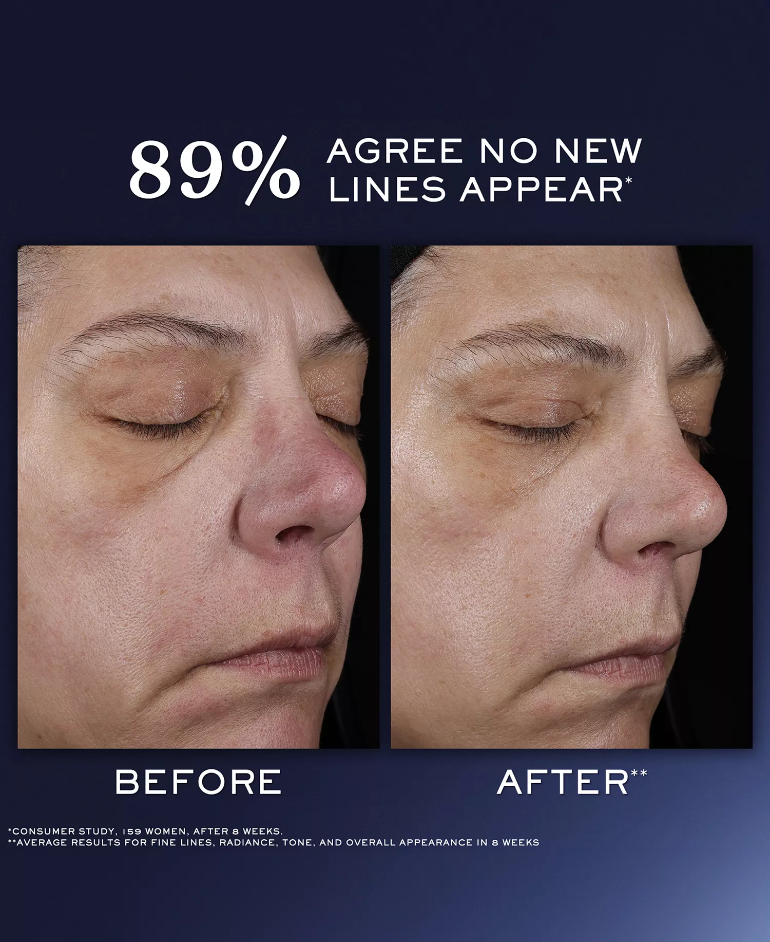 3-Pc. Génifique Ultimate Serum Mother's Day Skincare Set - No Color - No Size