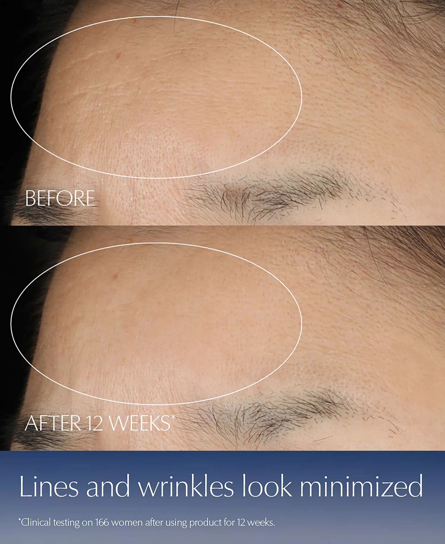 Advanced Night Repair Duo Synchronized Multi-Recovery Complex Serum with Hyaluronic Acid & Peptides, 1.7 oz Duo - No Color - 0.23 oz