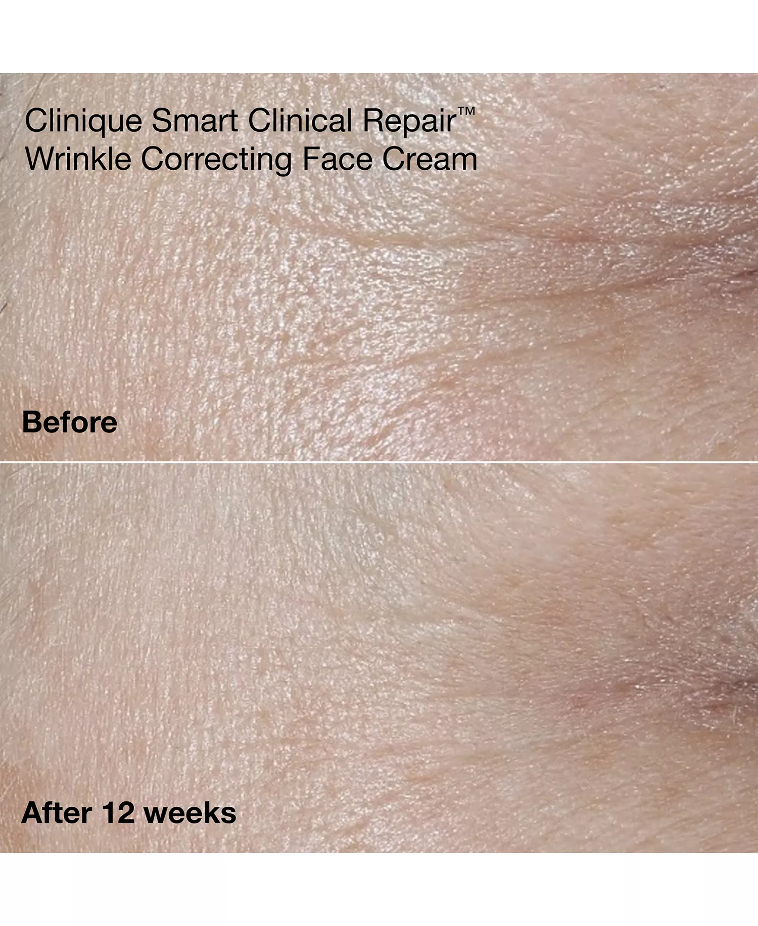 Wrinkle-Fighting Routine Anti-Aging Skin Care Gift Set