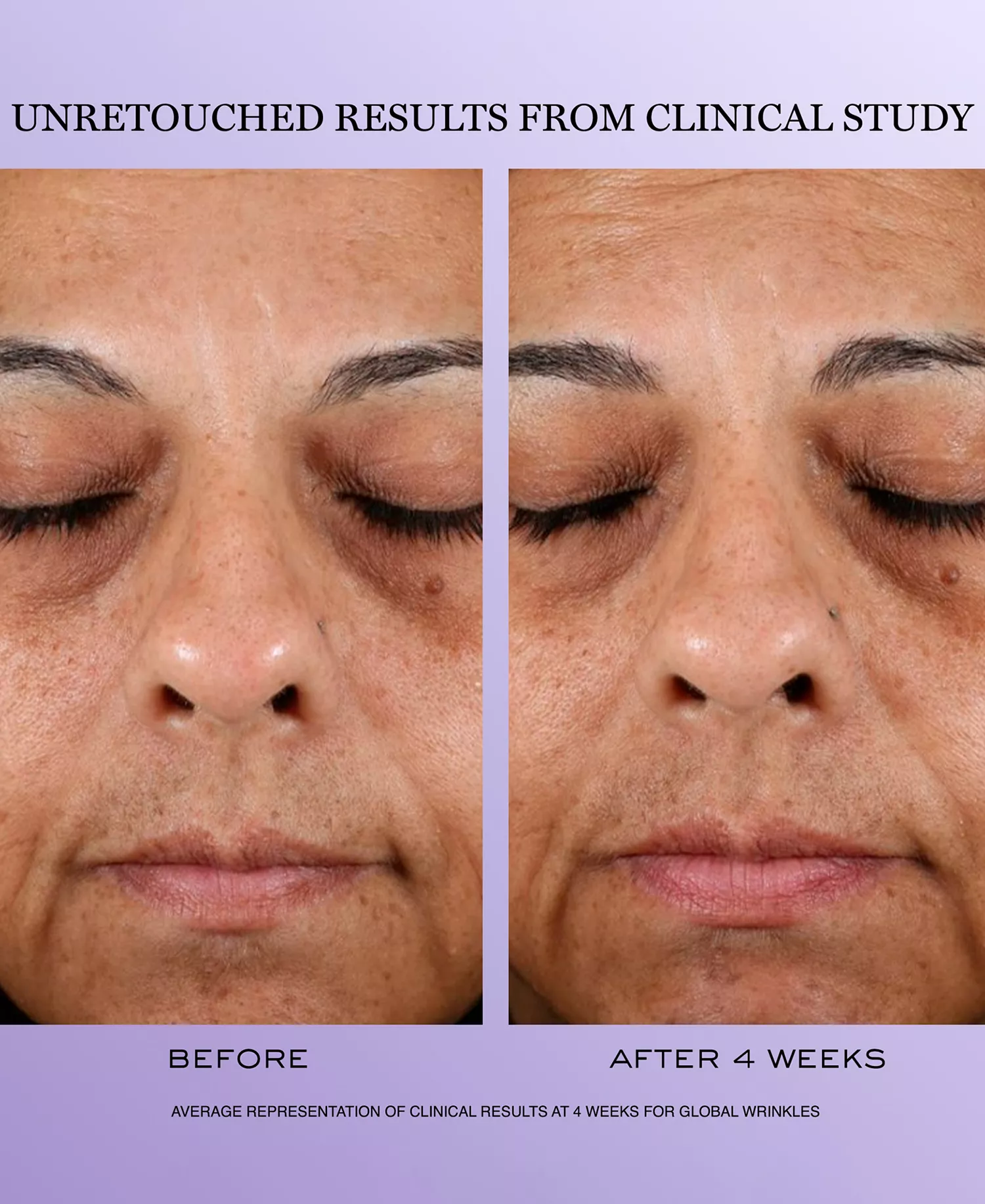 3-Pc. Rénergie H.C.F. Triple Serum Discovery Set - No Color - No Size